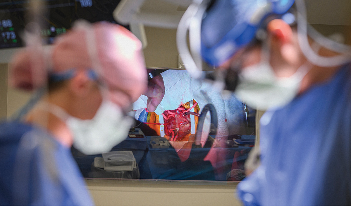 Surgical team members looking at a monitor displaying a close-up video of heart surgery.