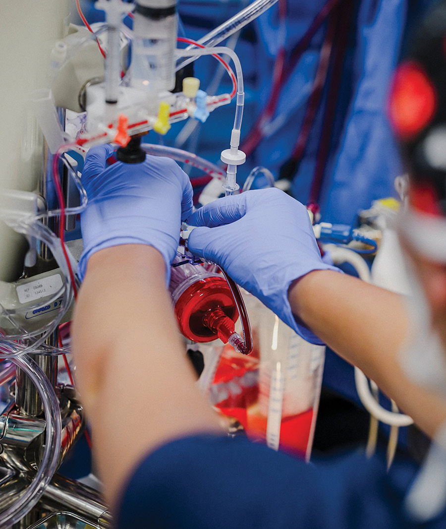 Close-up of gloved hands adjusting clear medical tubing connected to a blood reservoir.