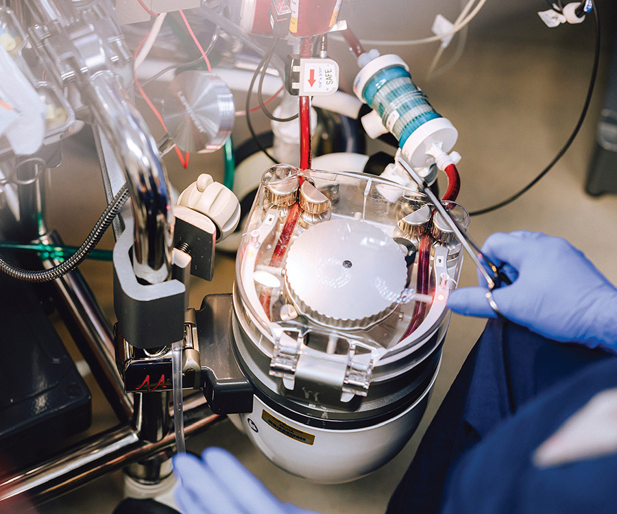 Overhead view of a gloved hand operating a mechanical roller pump component of a medical machine.